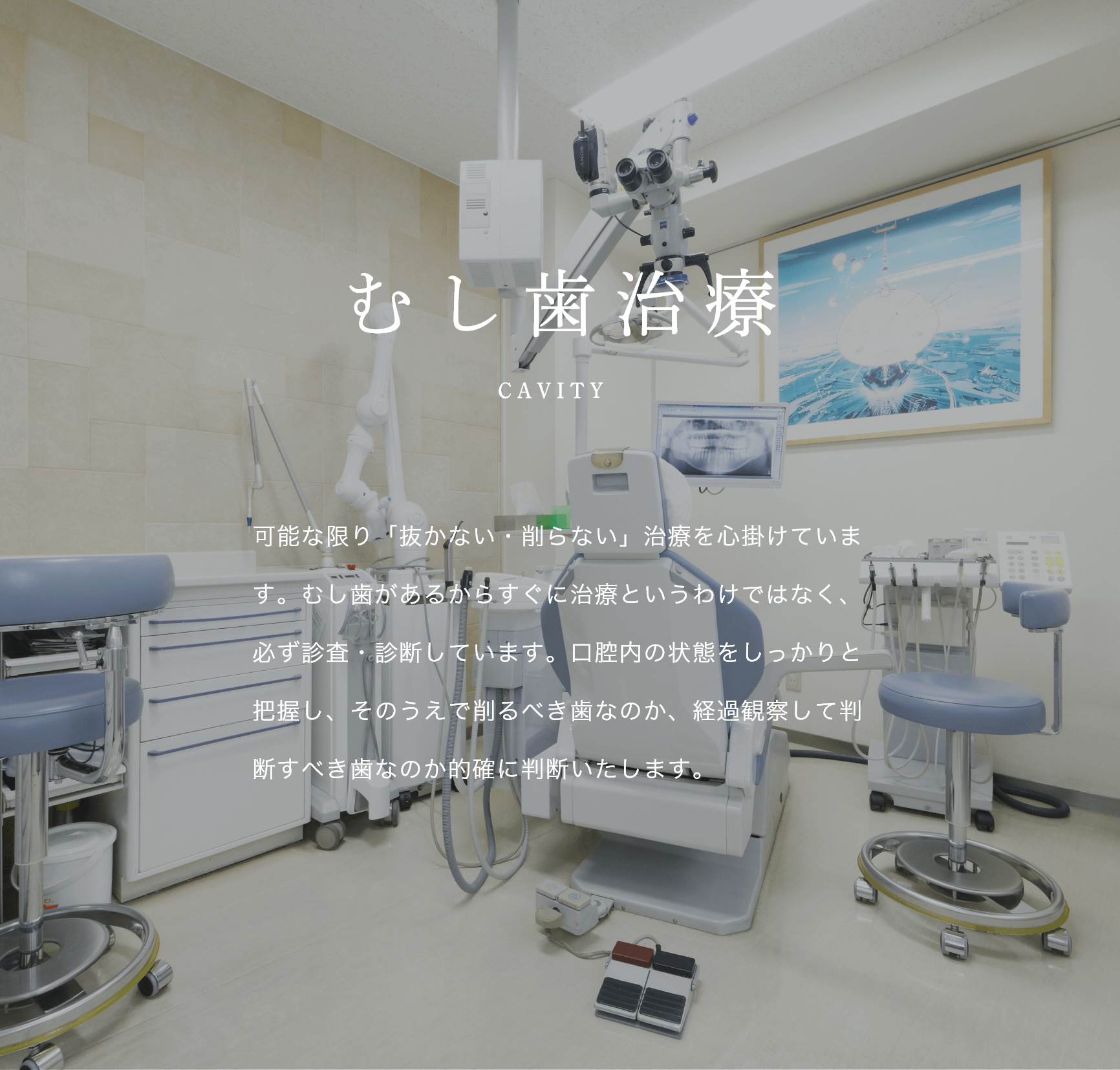 文京区後楽園・飯田橋の歯医者・矯正歯科「文京いわぶち歯科・矯正歯科」|むし歯治療 CAVITY 可能な限り「抜かない・削らない」治療を心掛けています。むし歯があるからすぐに治療というわけではなく、必ず診査・診断しています。口腔内の状態をしっかりと把握し、そのうえで削るべき歯なのか、経過観察して判断すべき歯なのか的確に判断いたします。