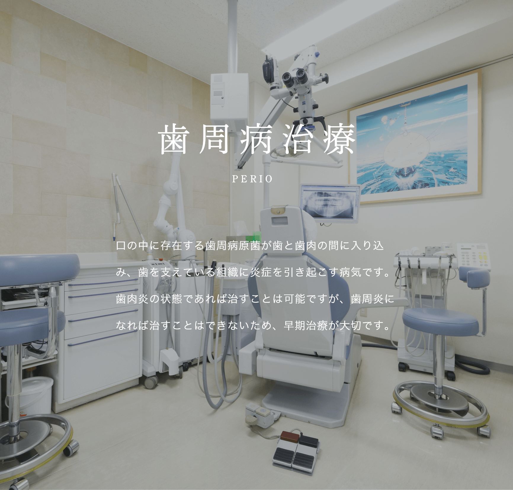 文京区後楽園・飯田橋の歯医者・矯正歯科「文京いわぶち歯科・矯正歯科」|歯周病治療 PERIO 口の中に存在する歯周病原菌が歯と歯肉の間に入り込み、歯を支えている組織に炎症を引き起こす病気です。歯肉炎の状態であれば治すことは可能ですが、歯周炎になれば治すことはできないため、早期治療が大切です。
